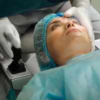 Cataract surgery