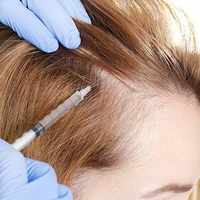 PRP Hair Treatment in Riyadh